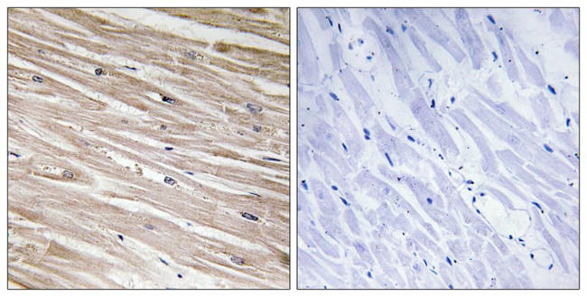 Phospho-PEA15 (Ser104) Antibody in Immunohistochemistry (Paraffin) (IHC (P))