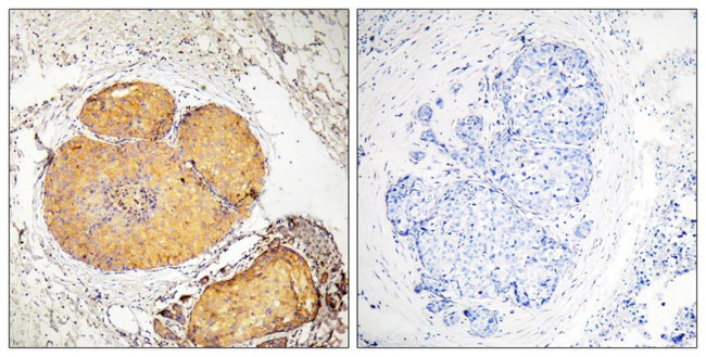 Phospho-FADD (Ser191) Antibody in Immunohistochemistry (Paraffin) (IHC (P))