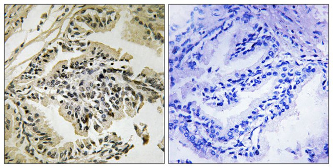 Phospho-PERK (Thr982) Antibody in Immunohistochemistry (Paraffin) (IHC (P))