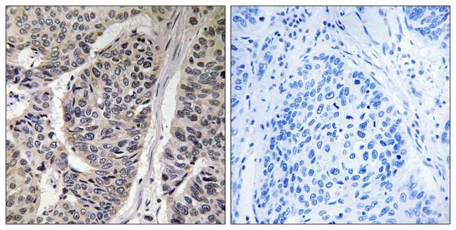 Phospho-p130Cas (Tyr410) Antibody in Immunohistochemistry (Paraffin) (IHC (P))