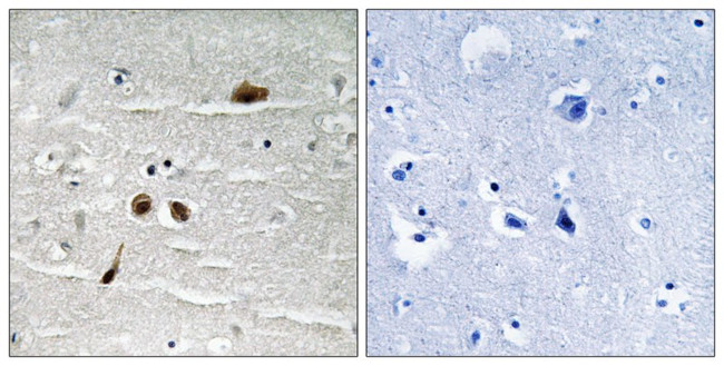 Phospho-MDC1 (Ser513) Antibody in Immunohistochemistry (Paraffin) (IHC (P))