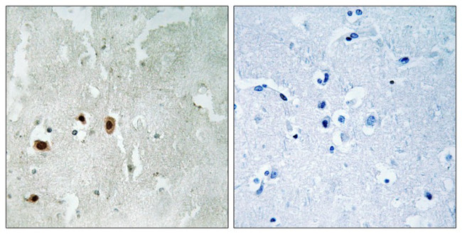 Phospho-TIP60 (Ser90) Antibody in Immunohistochemistry (Paraffin) (IHC (P))