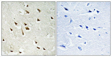 Phospho-GRF-1 (Tyr1105) Antibody in Immunohistochemistry (Paraffin) (IHC (P))