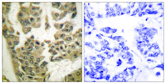 Phospho-GRF-1 (Tyr1105) Antibody in Immunohistochemistry (Paraffin) (IHC (P))