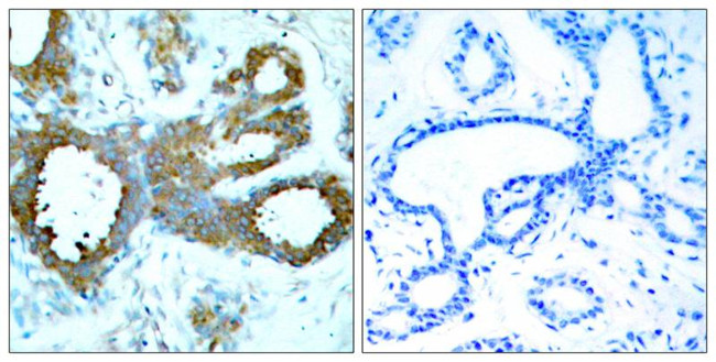 Phospho-PAK1/2/3 (Thr423, Thr402, Thr421) Antibody in Immunohistochemistry (Paraffin) (IHC (P))