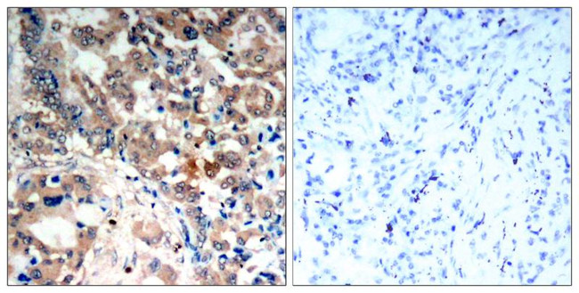 Phospho-AMPK alpha-1,2 (Thr172) Antibody in Immunohistochemistry (Paraffin) (IHC (P))