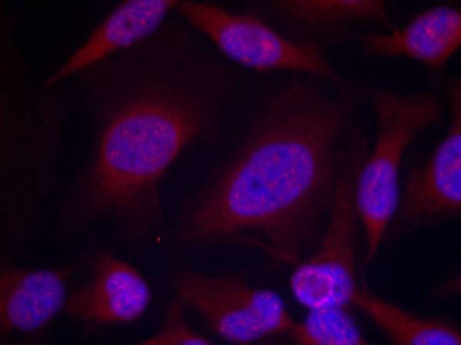 Phospho-JNK1/JNK2/JNK3 (Thr183, Tyr185) Antibody in Immunocytochemistry (ICC/IF)