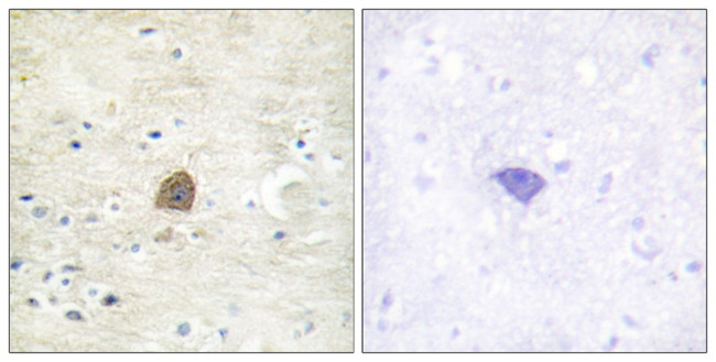 Phospho-CaMKII alpha/beta/delta (Thr305) Antibody in Immunohistochemistry (Paraffin) (IHC (P))