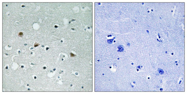 Phospho-LATS1/LATS2 (Thr1079, Thr1041) Antibody in Immunohistochemistry (Paraffin) (IHC (P))