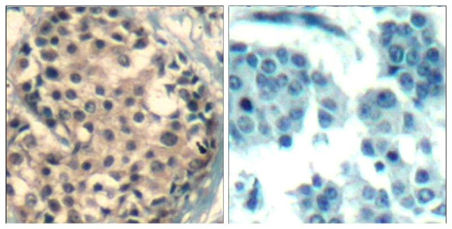 Phospho-HDAC4/HDAC5/HDAC9 (Ser246, Ser259, Ser220) Antibody in Immunohistochemistry (Paraffin) (IHC (P))