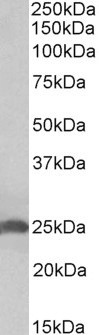 Apolipoprotein D Antibody in Western Blot (WB)