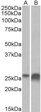 Apolipoprotein D Antibody in Western Blot (WB)