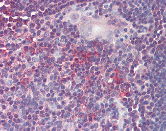 ARF4 Antibody in Immunohistochemistry (Paraffin) (IHC (P))