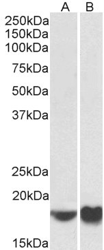 ARF4 Antibody in Western Blot (WB)