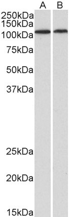 BMP1 Antibody in Western Blot (WB)