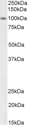 BMP1 Antibody in Western Blot (WB)