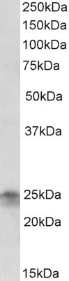 FGF8 Antibody in Western Blot (WB)