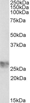 ICAM-4 Antibody in Western Blot (WB)