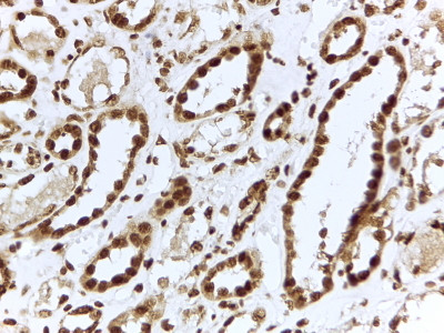 ILF3 Antibody in Immunohistochemistry (Paraffin) (IHC (P))