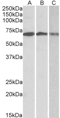 OAS2 Antibody in Western Blot (WB)