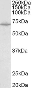 SLC6A8 Antibody in Western Blot (WB)