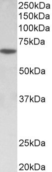 SOX11 Antibody in Western Blot (WB)