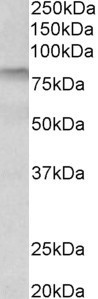 TGM3 Antibody in Western Blot (WB)