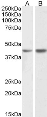 Podocin Antibody in Western Blot (WB)