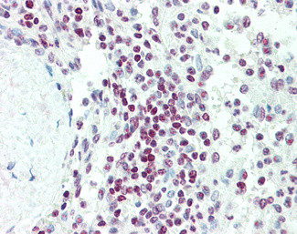 EDF1 Antibody in Immunohistochemistry (Paraffin) (IHC (P))