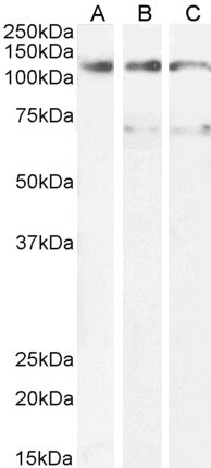 OSMR Antibody in Western Blot (WB)