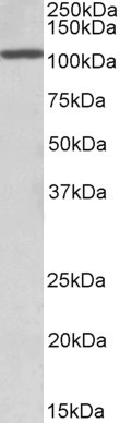 C/EBP zeta Antibody in Western Blot (WB)