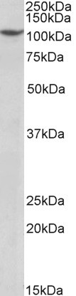 PRP6 Antibody in Western Blot (WB)