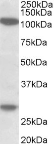 Ubinuclein 1/2 Antibody in Western Blot (WB)