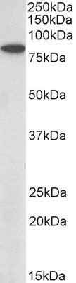 BBS7 Antibody in Western Blot (WB)