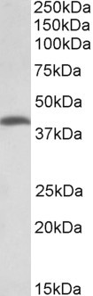 THNSL2 Antibody in Western Blot (WB)