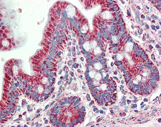 SLAMF8 Antibody in Immunohistochemistry (Paraffin) (IHC (P))