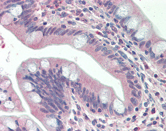 SLAMF8 Antibody in Immunohistochemistry (Paraffin) (IHC (P))