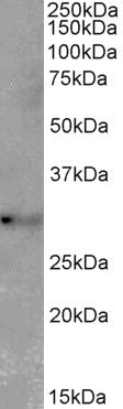 TSPAN14 Antibody in Western Blot (WB)