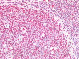 CSTF2 Antibody in Immunohistochemistry (Paraffin) (IHC (P))