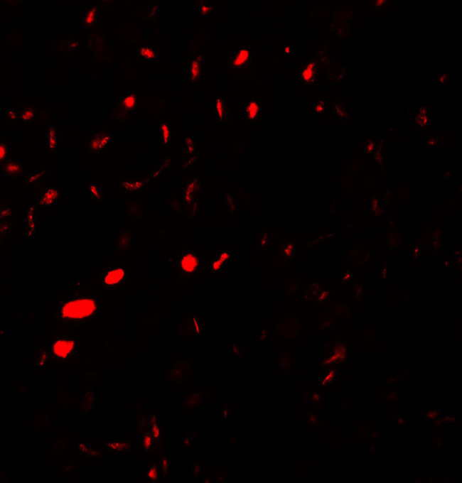 Aquaporin 2 Antibody in Immunohistochemistry (Paraffin) (IHC (P))