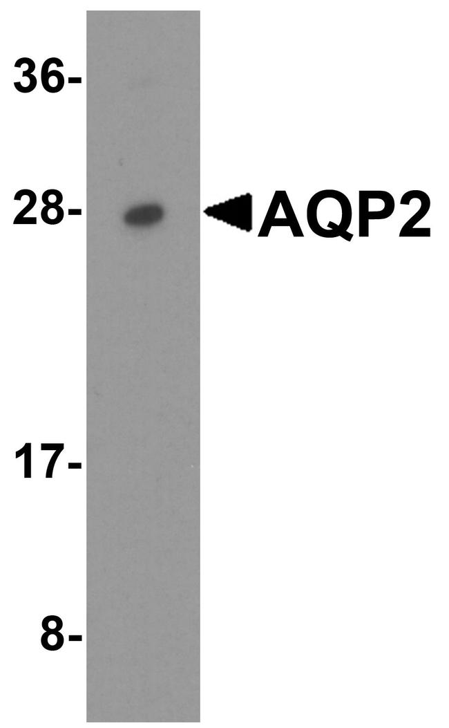 Aquaporin 2 Antibody in Western Blot (WB)