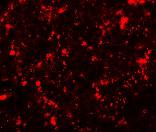 ME2 Antibody in Immunohistochemistry (Paraffin) (IHC (P))