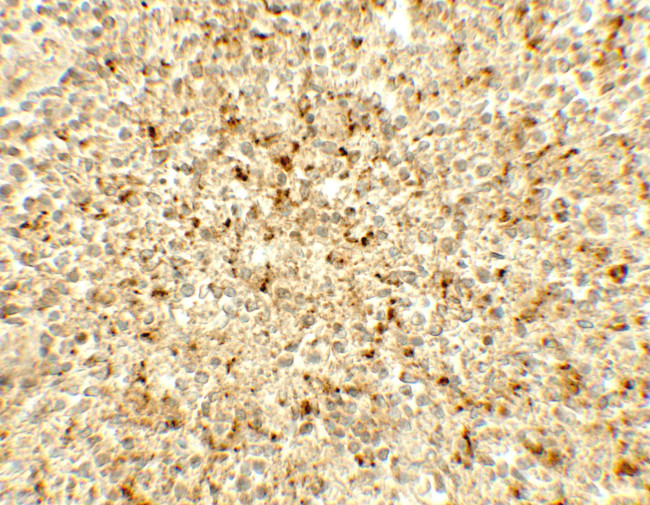 ME2 Antibody in Immunohistochemistry (Paraffin) (IHC (P))