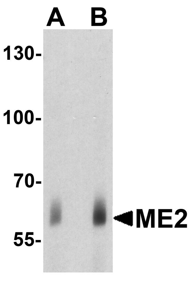 ME2 Antibody in Western Blot (WB)