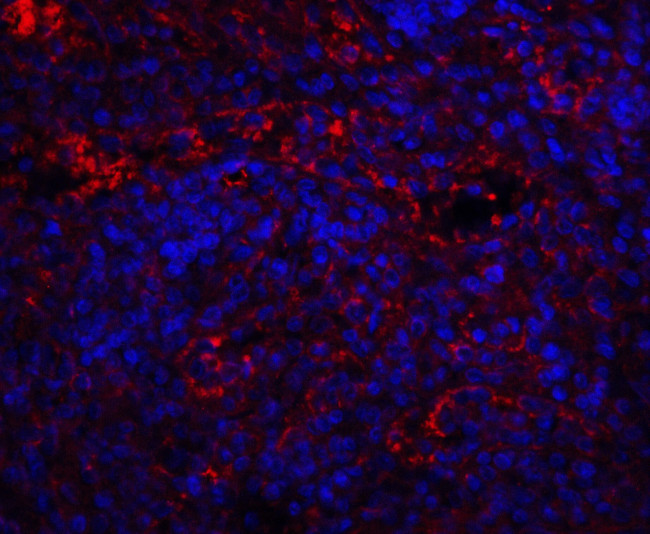 QSOX1 Antibody in Immunohistochemistry (IHC)