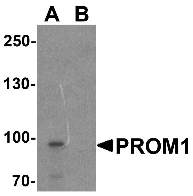 CD133 Antibody in Western Blot (WB)