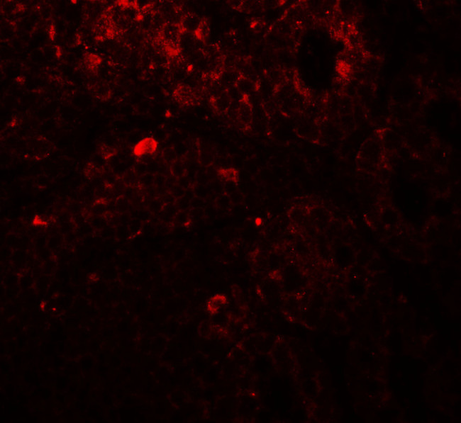 TRIP12 Antibody in Immunohistochemistry (Paraffin) (IHC (P))