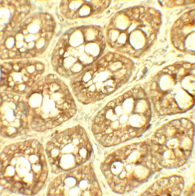 TRIP12 Antibody in Immunohistochemistry (Paraffin) (IHC (P))