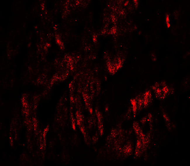 WAPL Antibody in Immunohistochemistry (Paraffin) (IHC (P))