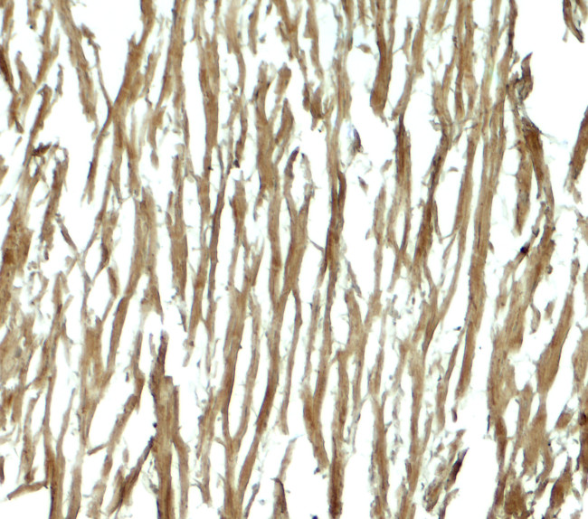 DNAJC13 Antibody in Immunohistochemistry (Paraffin) (IHC (P))